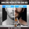 Beard Growth Kit – Oil, Balm, Serum, Derma Roller & Wooden Comb for Beard & Mustache Growth(Beard Growth Kit)