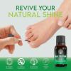 Toenail Solution Extra Strength – Athlete’s Foot, Toe & Finger Nail Treatment