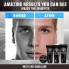 Viking Revolution Men’s Facial Skin Care Kit – Includes Rejuvenating Face Moisturizer, Microdermabrasion Facial Scrub, Foaming Cleanser (5oz Each) and Eye Cream (1oz)